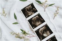 Kala Rath newborn photography